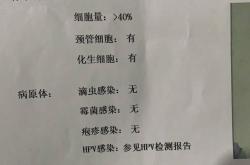 广州南粤医院治疗妇科疑难疾病更加专业，值得信赖的医院