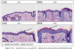 二二五团：做好“两癌”筛查 守护女性健康