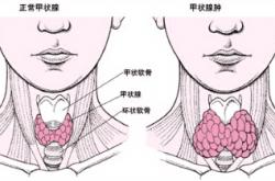 打鱼机网络监控软件-【深邕携手进马山 生殖交流促健康】深圳、南宁医疗力量汇聚马山，共筑生殖健康梦