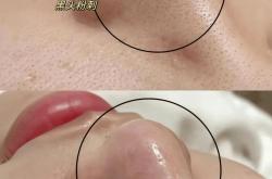 7790com必发集团下截-守护女性生殖健康：从认识到行动