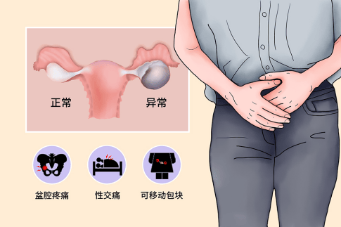 祛皱美白的方法是什么？精选五大抗皱淡纹护肤品推荐