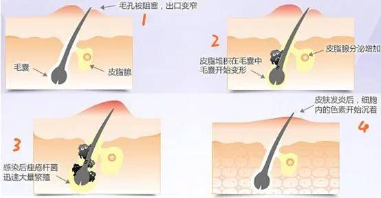 澳门国际06588-佛山升平医院提醒：女性健康生活的关键