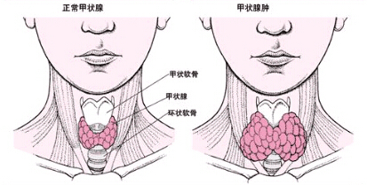 打鱼机网络监控软件-【深邕携手进马山 生殖交流促健康】深圳、南宁医疗力量汇聚马山，共筑生殖健康梦