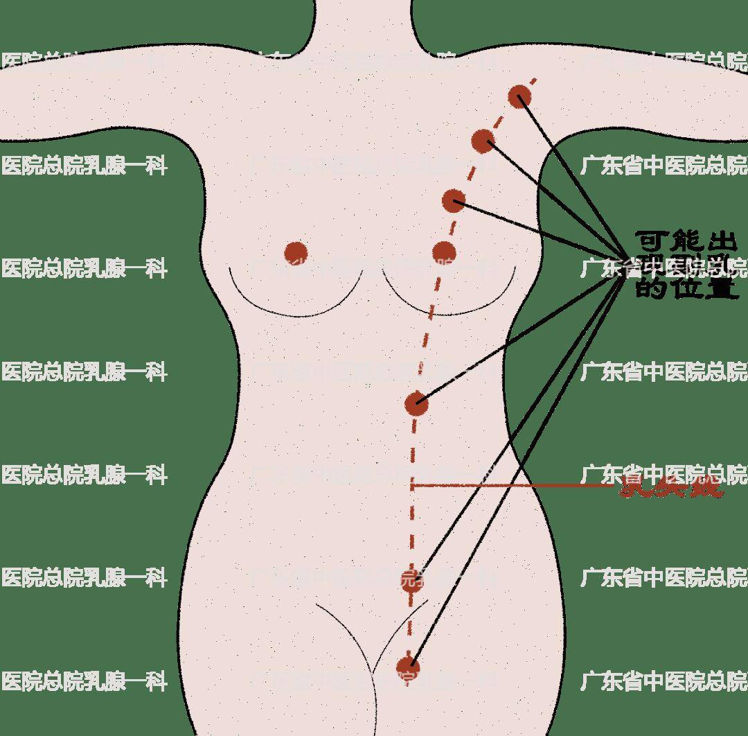 揭秘隐形糖陷阱：你的健康饮食必修课