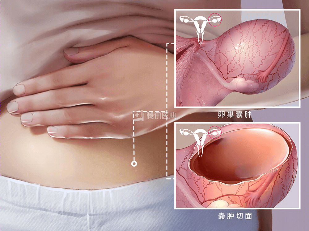 男人生殖健康问题严峻，预防生殖感染要做什么？